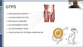 Gluteus Medius Tendon Tears [upl. by Scheider318]