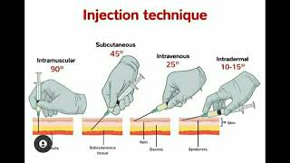 Injection Techniques quotIntermuscular Subcutaneous Intravenous Intradermalquot [upl. by Akinot]