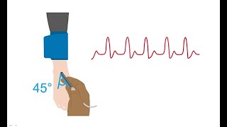 Performing a manual anklebrachial index ABI [upl. by Rentsch]