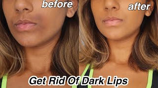 How To Get rid Of Dark Lips And Pigmentation [upl. by Aliak]