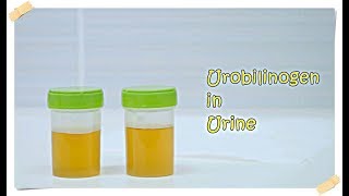 Urobilinogen in Urine [upl. by Hakaber]