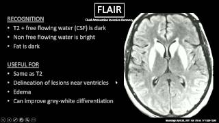 MRI Sequences [upl. by Yznil]