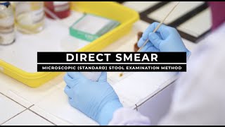 Direct Smear  Microscopic Standard Stool Examination Method [upl. by Holman]