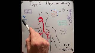 Asthma Explained Clearly Asthma Symptoms and Diagnosis [upl. by Capon838]