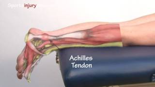 Achilles Tendonitis  Tendinopathy  Explained in 90 Seconds [upl. by Williams]