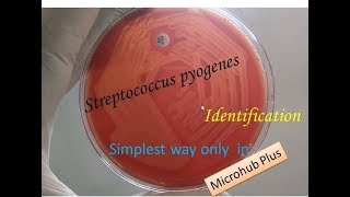 Streptococcus pyogenes identification [upl. by Torrlow]