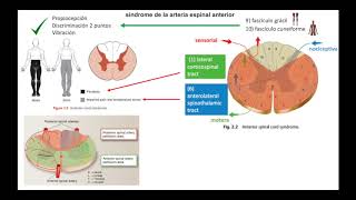 Lesiones de la Medula Espinal [upl. by Leuqram]