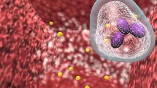 Bacterial infection and host response [upl. by Adlin]