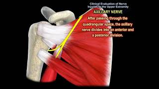 NERVE INJURY IN THE UPPER EXTREMITY Everything You Need To Know  Dr Nabil Ebraheim [upl. by Ailee145]