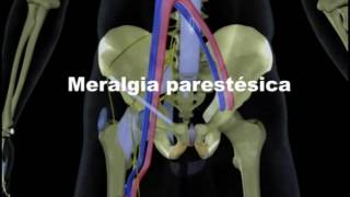 Meralgia Parestésica [upl. by Bobker]