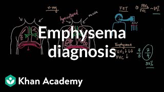 Emphysema diagnosis  Respiratory system diseases  NCLEXRN  Khan Academy [upl. by Yeslehc]