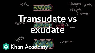 Transudate vs exudate  Respiratory system diseases  NCLEXRN  Khan Academy [upl. by Lubeck]