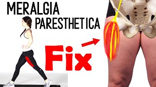 Meralgia paresthetica  upper leg pain  upper thigh pain [upl. by Merri308]