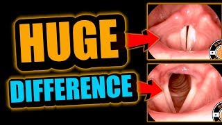 Singing amp Rapping Basics How Do Vocal Cords Work [upl. by Beaston195]