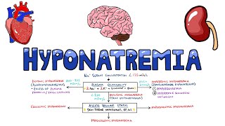 An Approach to Hyponatremia  Hyponatremia Diagnostic Algorithm  Hyponatremia Causes MADE EASY [upl. by Rianon]