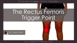 The Rectus Femoris Trigger Point [upl. by Leach105]