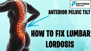 How To Fix Lumbar Lordosis and Anterior Pelvic Tilts  Full Exercise and Stretch Plan [upl. by Swetiana825]