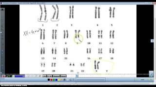 Karyotype analysis [upl. by Marillin]