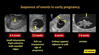 Advanced Evaluation of the Fetal Heart [upl. by Chien]