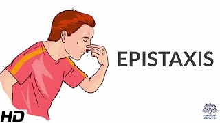 Epistaxis Causes SIgns and Symptoms Diagnosis and Treatment [upl. by Ihcekn]