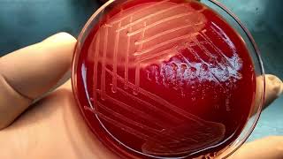 Colony morphology of bacteria  beta haemolytic streptococci  S pyogenes S agalactiae [upl. by Dieball]