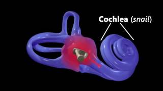 EAR INFECTION vs PERFECT EAR Inside Look  Dr Paul [upl. by Eldnar451]