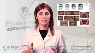 Ortodoncia tipos y tratamiento · Dental Internacional [upl. by Theda166]