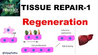 TISSUE REPAIR Part 1 Repair  Regeneration [upl. by Derreg]