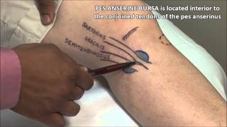 AOA Orthopedic Specialists  Subacromial Bursitis [upl. by Yacano]