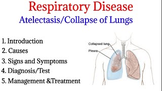 Atelectasis  Introduction causes signs ampsymptoms diagnosis and treatment  Respiratory disease [upl. by Eelegna134]