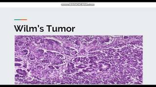 Wilms Tumor [upl. by Neufer885]