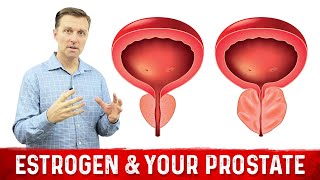 How To Fix Enlarged Prostate Explained By Dr Berg [upl. by Flemings]