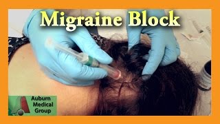 The cuttingedge treatments for migraines l GMA [upl. by Ellinad]