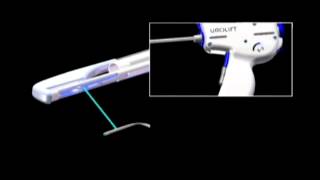 UroLift Procedure for BPH  Dr David Harris [upl. by Cartwright245]