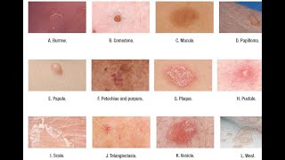 Skin Lesions with defination [upl. by Casanova]