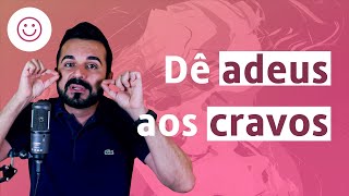 Como Remover Cravos do Rosto de Forma Natural  Dr Rafael Freitas [upl. by Aizitel]