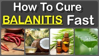 How To Cure Balanitis With Oils Fast And Causes Symptoms And Treatment Of Balanitis [upl. by Solana]