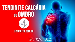 DOR no OMBRO TENDINITE CALCÁRIA CAUSAS e TRATAMENTO de FISIOTERAPIA  Fisioterapia Dr Robson Sitta [upl. by Atenahs]