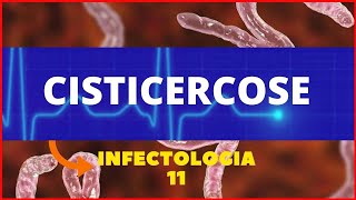 CISTICERCOSE  TAENIA SOLIUM  PARASITOLOGIA  INFECTOLOGIA [upl. by Gardell422]