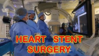 Heart Stent Surgery [upl. by Ahsinahs]