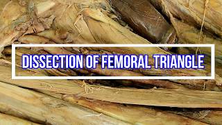 Dissection of Femoral Triangle [upl. by Arihppas]