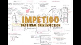 Impetigo Bacterial Skin Infection  Overview Clinical Presentation Pathophysiology Treatment [upl. by Jutta]