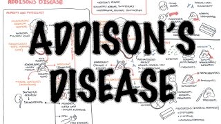 Addisons Disease  Overview clinical features pathophysiology investigations treatment [upl. by Ynaffet621]