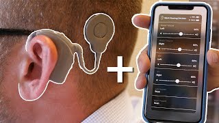 Cochlear Implants and Smartphones are Changing Lives [upl. by Khan855]