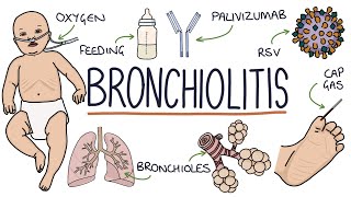 Understanding Bronchiolitis [upl. by Imrots]