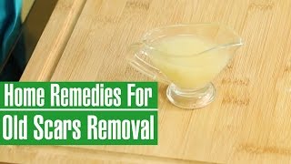 HOW TO REMOVE OLD SCARS FROM LEGS amp FACE  Natural Scar Removal [upl. by Elladine]