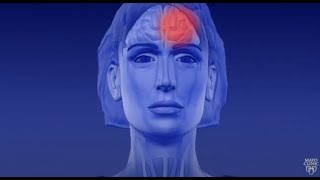 What Causes Headaches – Dr Berg [upl. by Idnal830]