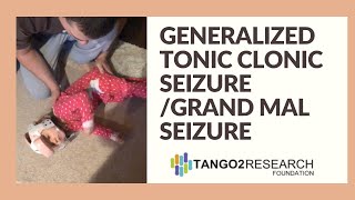 Generalized Tonic Clonic Seizure  Grand Mal Seizure [upl. by Arluene]