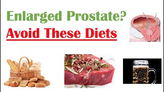 Foods to Avoid with Enlarged Prostate  Reduce Symptoms and Risk of Prostate Cancer [upl. by Aiclid]