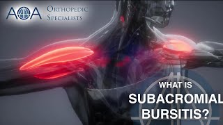 What is Shoulder Bursitis [upl. by Yetsirhc629]